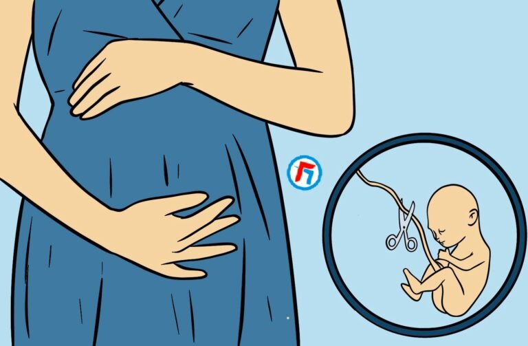 ABORSI TERNYATA BOLEH! BERIKUT PENJELASANNYA! 